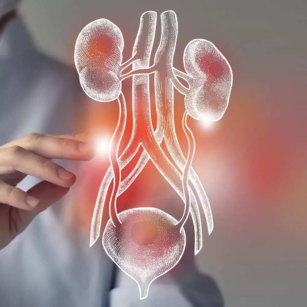 Câncer Renal